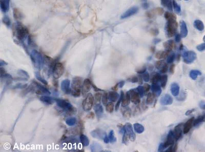 Immunohistochemistry (Formalin/PFA-fixed paraffin-embedded sections) - Anti-RIP140 antibody (AB42126)