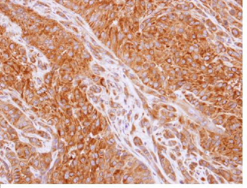 Immunohistochemistry (Formalin/PFA-fixed paraffin-embedded sections) - Anti-RIP2 antibody (AB155529)