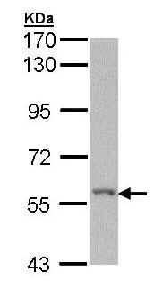 Western blot - Anti-RIP2 antibody (AB155529)