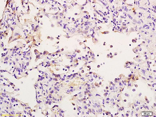 Immunohistochemistry (Formalin/PFA-fixed paraffin-embedded sections) - Anti-RIP2 antibody (AB217549)