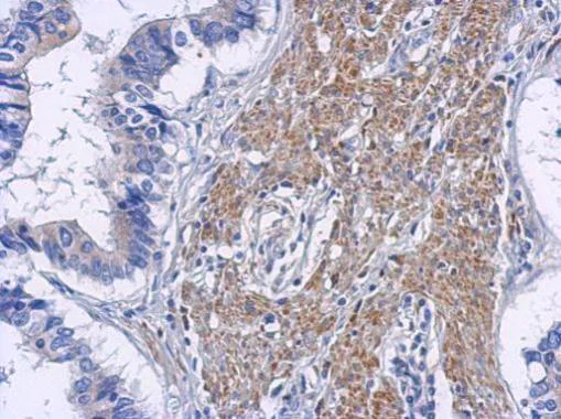 Immunohistochemistry (Formalin/PFA-fixed paraffin-embedded sections) - Anti-RIP2 antibody (AB272886)