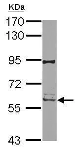 Western blot - Anti-RIP2 antibody (AB272886)