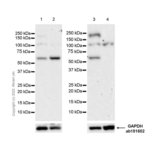 Western blot - Anti-RIP2 antibody [EPR26079-37] (AB303554)