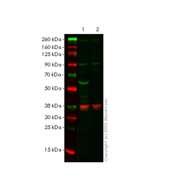 Western blot - Anti-RIP2 antibody [EPR26079-37] - BSA and Azide free (AB303555)