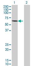Western blot - RIP2 overexpression 293T lysate (whole cell) (AB94131), expandable thumbnail