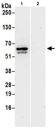 Immunoprecipitation - Anti-RIP3 antibody (AB226297)