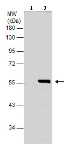 Western blot - Anti-RIP3 antibody (AB246523), expandable thumbnail