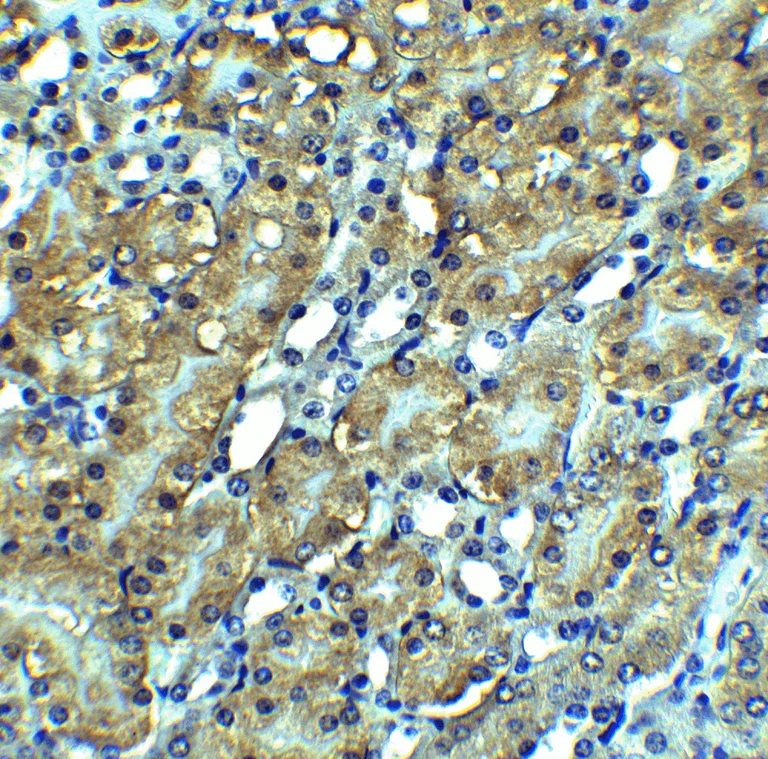 Immunohistochemistry (Formalin/PFA-fixed paraffin-embedded sections) - Anti-RIP3 antibody (AB62344)