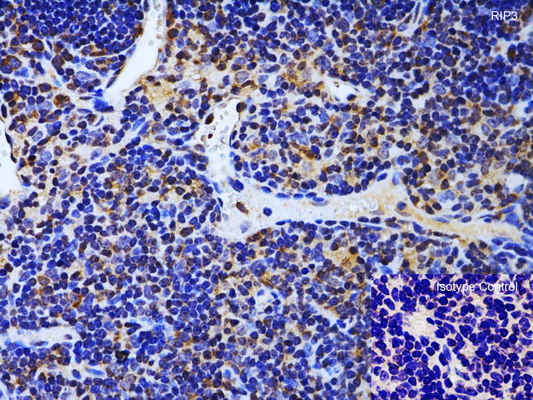Immunohistochemistry (Formalin/PFA-fixed paraffin-embedded sections) - Anti-RIP3 antibody (AB62344)