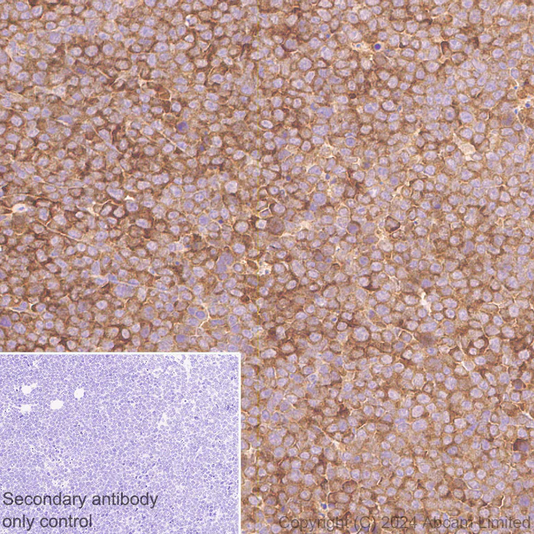 Immunohistochemistry (Formalin/PFA-fixed paraffin-embedded sections) - Anti-RIP3 antibody [EPR26080-567] - BSA and Azide free (AB325961)