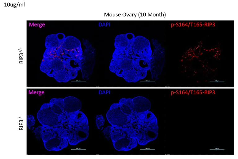 Immunohistochemistry (Frozen sections) - Anti-RIP3 (phospho S164 + T165) antibody [EPR23660-20] (AB255705)