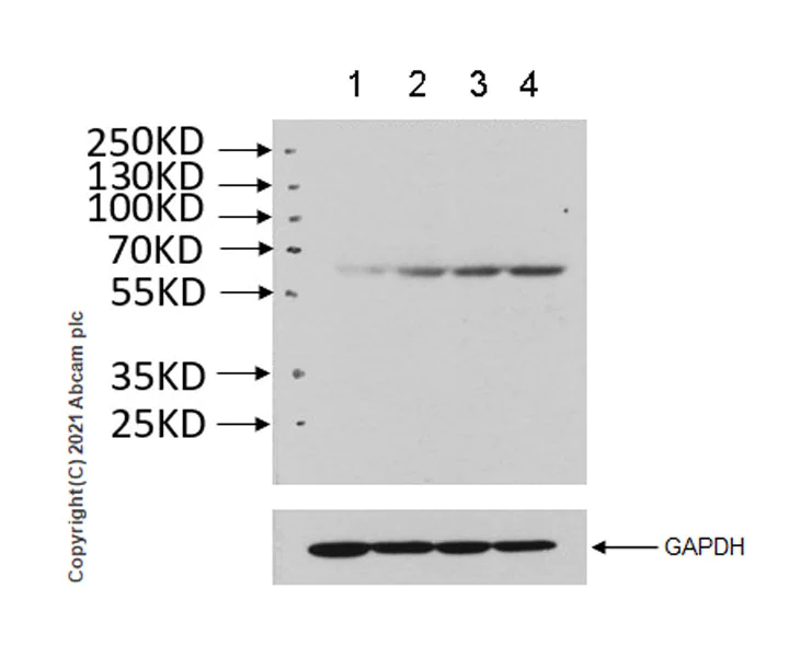 Western blot - Anti-RIP3 (phospho S164 + T165) antibody [EPR23660-20] (AB255705)