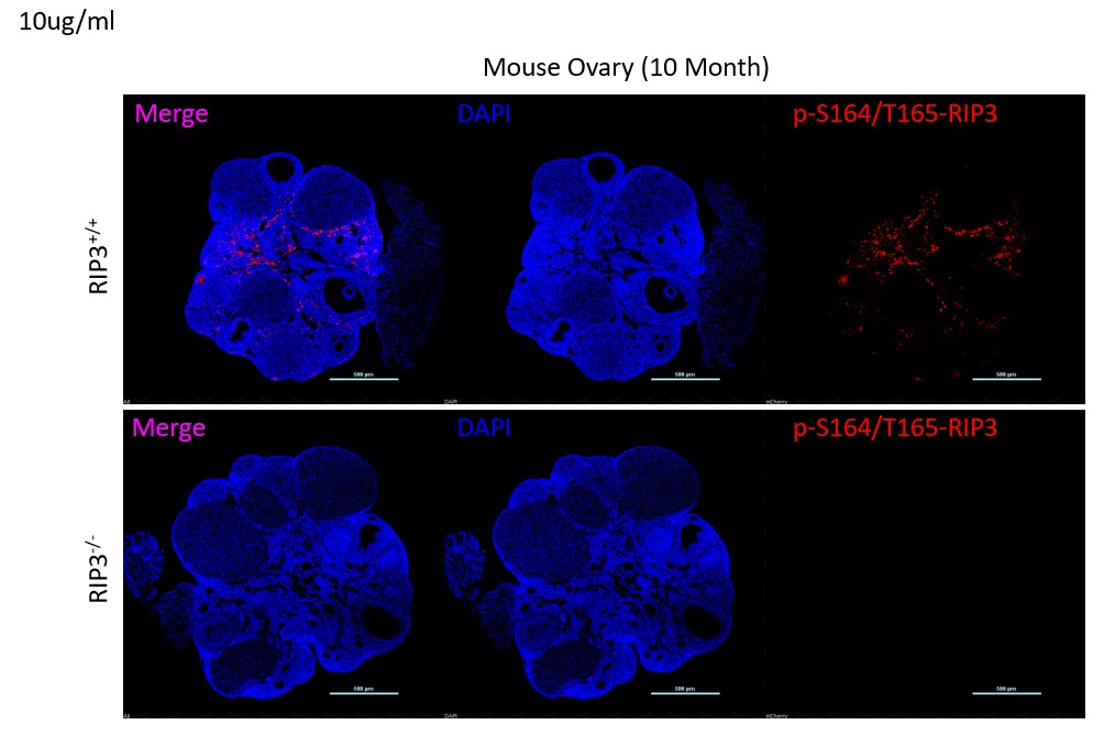 Immunohistochemistry (Frozen sections) - Anti-RIP3 (phospho S164 + T165) antibody [EPR23660-20] - BSA and Azide free (AB284393)