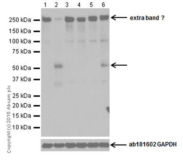 Western blot - Anti-RIP3 (phospho S232) antibody [EPR9516(N)-25] (AB195117), expandable thumbnail