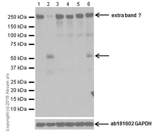 Western blot - Anti-RIP3 (phospho S232) antibody [EPR9516(N)-25] (AB195117)