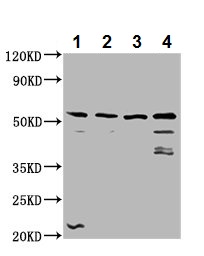Western blot - Anti-RIPX antibody (AB237511), expandable thumbnail