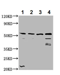 Western blot - Anti-RIPX antibody (AB237511)