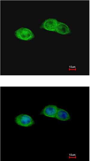 Immunocytochemistry/ Immunofluorescence - Anti-RISC antibody (AB154758)