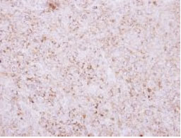 Immunohistochemistry (Formalin/PFA-fixed paraffin-embedded sections) - Anti-RIT1/RIT antibody (AB127041)