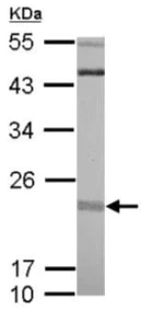 Western blot - Anti-RIT1/RIT antibody (AB127041)