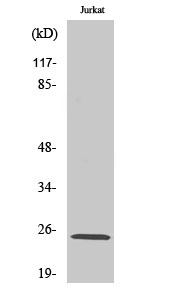Western blot - Anti-RIT1/RIT antibody (AB53720), expandable thumbnail
