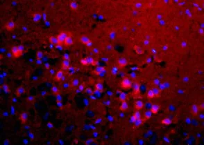 Immunohistochemistry (Formalin/PFA-fixed paraffin-embedded sections) - Anti-RIZ1 antibody (AB204110)