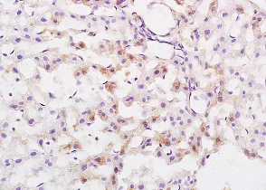 Immunohistochemistry (Formalin/PFA-fixed paraffin-embedded sections) - Anti-RIZ1 antibody (AB204110)