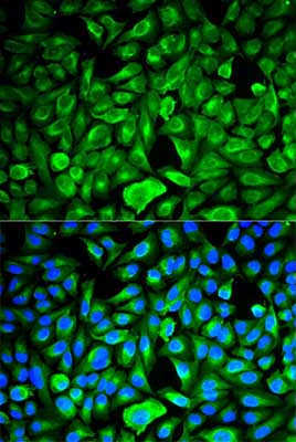 Immunocytochemistry/ Immunofluorescence - Anti-RKIP antibody (AB196832)