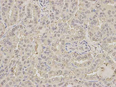 Immunohistochemistry (Formalin/PFA-fixed paraffin-embedded sections) - Anti-RKIP antibody (AB196832)