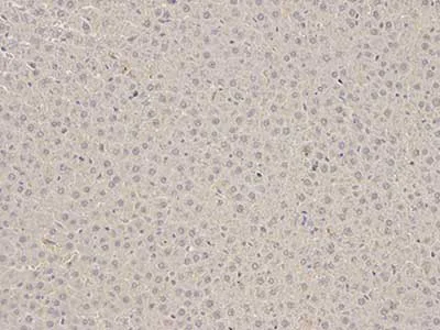 Immunohistochemistry (Formalin/PFA-fixed paraffin-embedded sections) - Anti-RKIP antibody (AB196832)