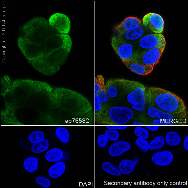 Immunocytochemistry/ Immunofluorescence - Anti-RKIP antibody [EPR2875Y] (AB76582)
