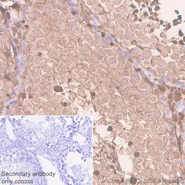 Immunohistochemistry (Formalin/PFA-fixed paraffin-embedded sections) - Anti-RKIP antibody [EPR2875Y] (AB76582)