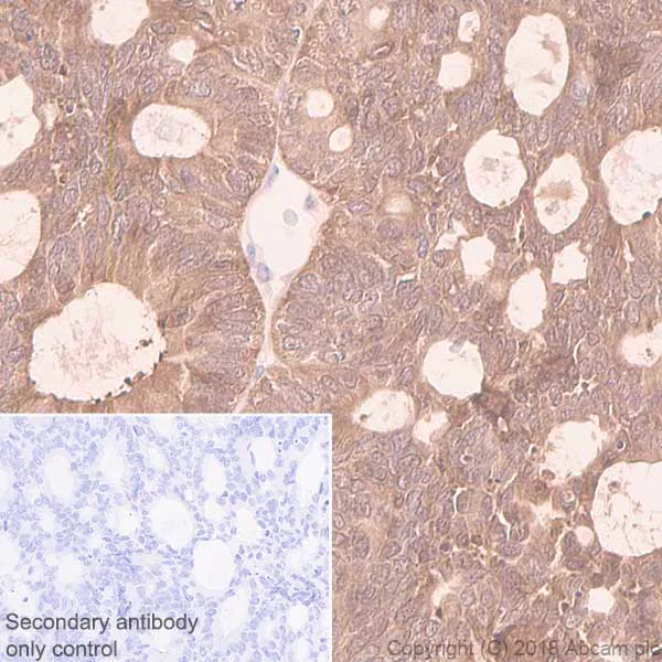Immunohistochemistry (Formalin/PFA-fixed paraffin-embedded sections) - Anti-RKIP antibody [EPR2875Y] (AB76582)
