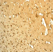 Immunohistochemistry (Formalin/PFA-fixed paraffin-embedded sections) - Anti-RKIP antibody [EPR2875Y] (AB76582)