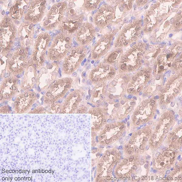 Immunohistochemistry (Formalin/PFA-fixed paraffin-embedded sections) - Anti-RKIP antibody [EPR2875Y] (AB76582)