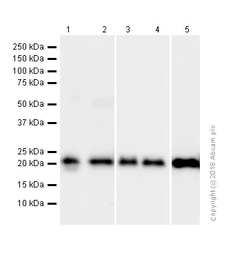 Western blot - Anti-RKIP antibody [EPR2875Y] (AB76582)