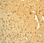 Immunohistochemistry (Formalin/PFA-fixed paraffin-embedded sections) - Anti-RKIP antibody [EPR2875Y] - BSA and Azide free (AB239887)