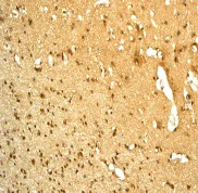 Immunohistochemistry (Formalin/PFA-fixed paraffin-embedded sections) - Anti-RKIP antibody [EPR2875Y] - BSA and Azide free (AB239887)