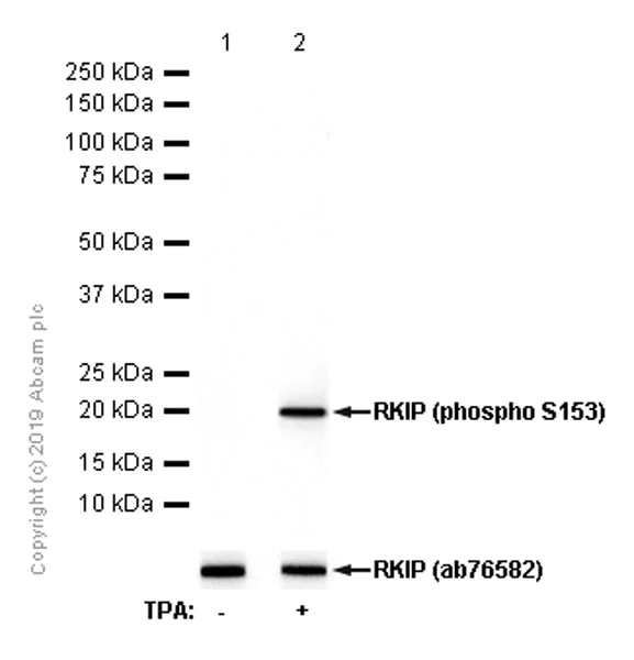 Western blot - Anti-RKIP (phospho S153) antibody [EP2845Y] - BSA and Azide free (AB247417)