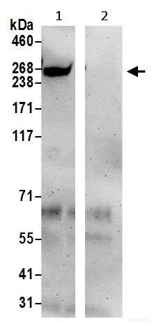 Immunoprecipitation - Anti-RME-8 antibody (AB241959)
