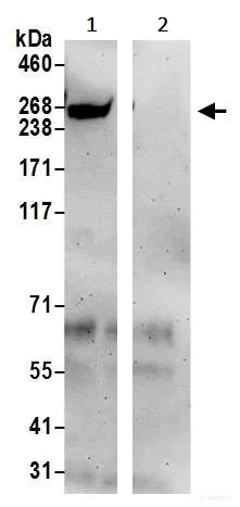 Immunoprecipitation - Anti-RME-8 antibody (AB241959)