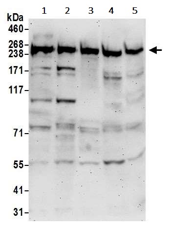 Western blot - Anti-RME-8 antibody (AB241959)