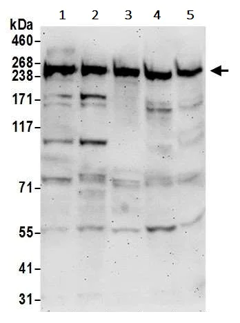 Western blot - Anti-RME-8 antibody (AB241959)