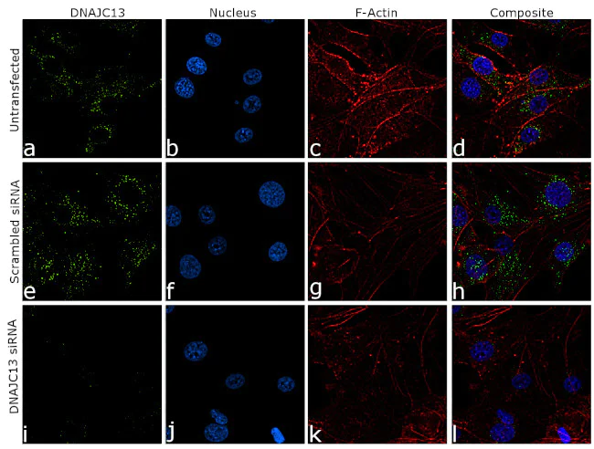 Immunocytochemistry/ Immunofluorescence - Anti-RME-8 Antibody [RP23040241] (AB313497)