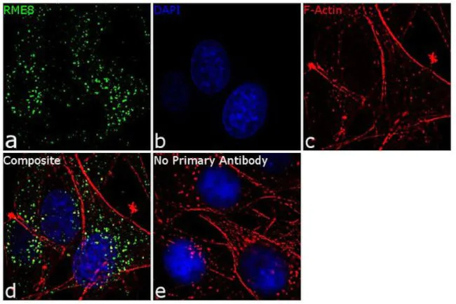 Immunocytochemistry/ Immunofluorescence - Anti-RME-8 antibody [RP23040241] (AB313497)