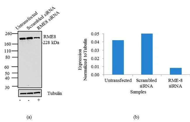 Western blot - Anti-RME-8 Antibody [RP23040241] (AB313497)