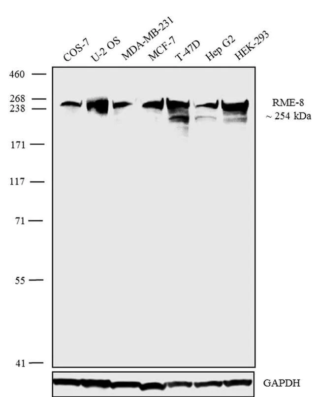 Western blot - Anti-RME-8 Antibody [RP23040241] (AB313497)