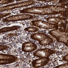 Immunohistochemistry (Formalin/PFA-fixed paraffin-embedded sections) - Anti-RMI2 antibody (AB122685)