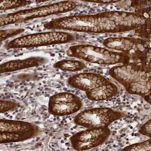 Immunohistochemistry (Formalin/PFA-fixed paraffin-embedded sections) - Anti-RMI2 antibody (AB122685)