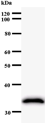 Western blot - Anti-RNA Helicase A antibody [2274D5a] (AB53668)